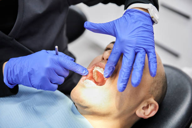 Best Emergency Cosmetic Dentistry (e.g., broken veneers) in Bluffton, SC